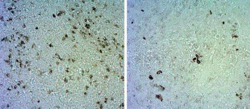 Novel monoclonal antibody inhibits tumor growth in breast cancer and angiosarcoma