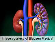 Novel racial/Ethnic differences found in diabetic kidney disease