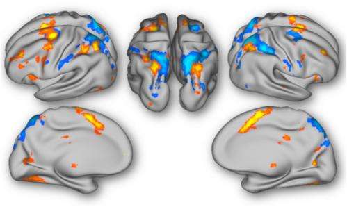 To predict, perchance to update: Neural responses to the unexpected