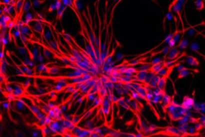 Physical cues help mature cells revert into embryonic-like stem cells