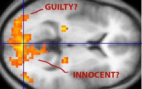 Predicting repeat offenders with brain scans: You be the judge