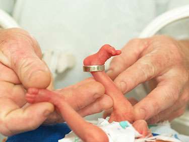 Prematurity, low birth weight significantly impact mortality rates