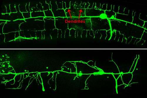Previously unstudied gene is essential for normal nerve development