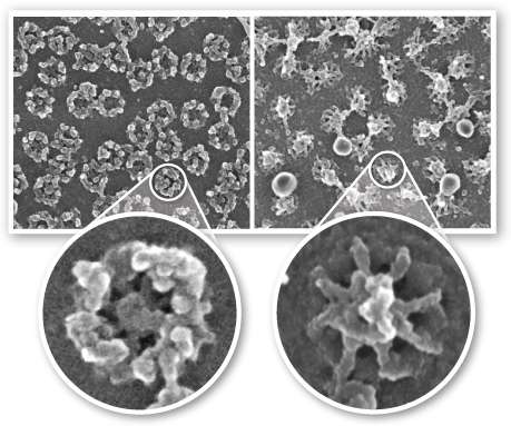 Protein lifetime and the stability of cell structures