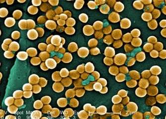 Rapid detection of superbugs