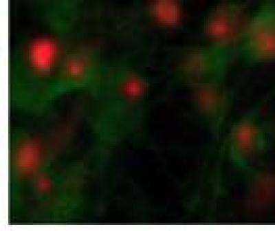 大鼠海马神经元:神经炎症的执行者