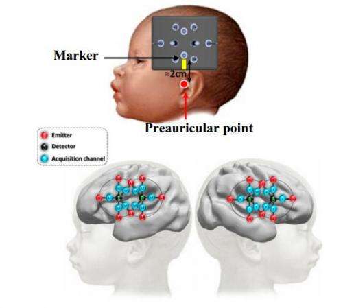 Study shows human brain able to discriminate syllables three months prior to birth