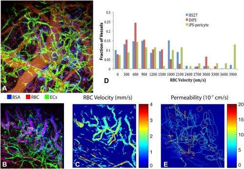 Patient, heal thyself: Functional blood vessels regenerated in vivo from human induced pluripotent stem cells