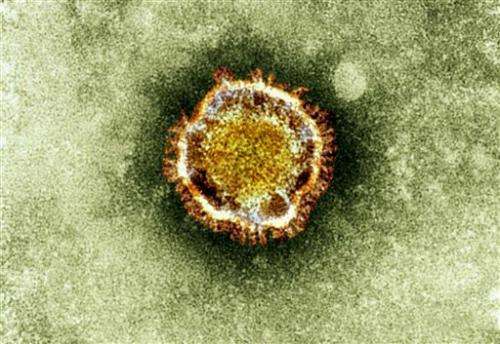 SARS-linked病毒可能会在人与人之间传播