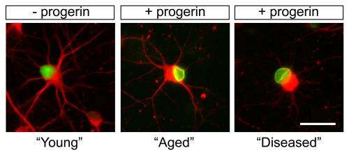 科学家在干细胞加速老化研究老年性疾病如帕金森症