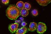 形状转移细胞有助于皮肤癌扩散