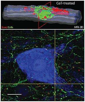 干细胞注射改善大鼠脊柱损伤
