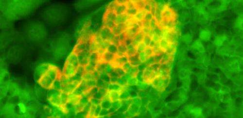Stem cells could set up future transplant therapies