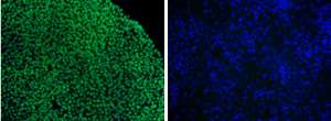 Stem cells: Keeping differentiation in check