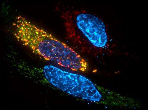 Study IDs key protein for cell death