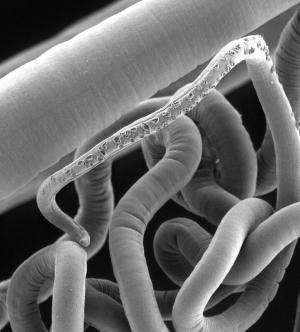 Study makes important step-forward in mission to tackle parasitic worm infections
