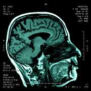 研究探测海洛因成瘾对大脑的影响