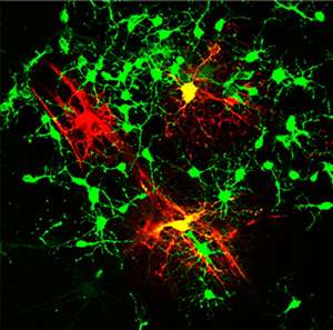 Team 'spikes' stem cells to generate myelin