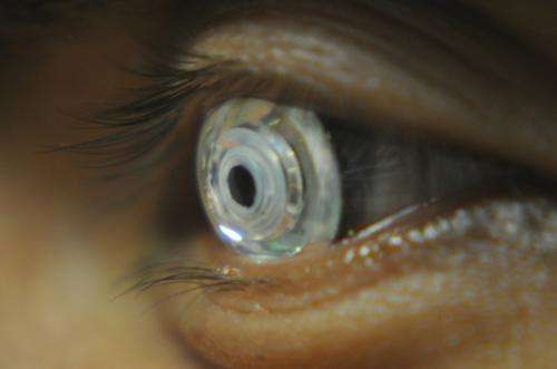 Telescopic contact lens could improve eyesight for the visually impaired