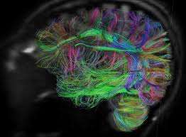 大脑是活着,将新的核磁共振扩散技术让我们看到它移动和动摇?