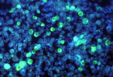 Thwarting herpes, scientists open antiviral drug path