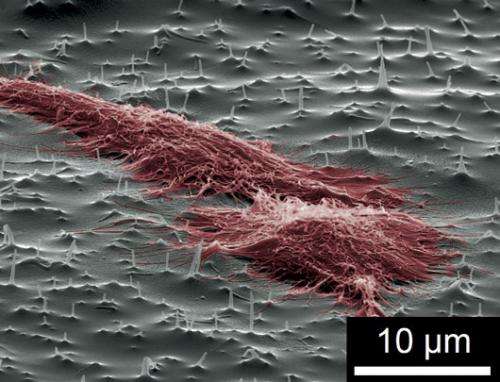 Tiny needles can force medicine into cells, even when they resist taking it