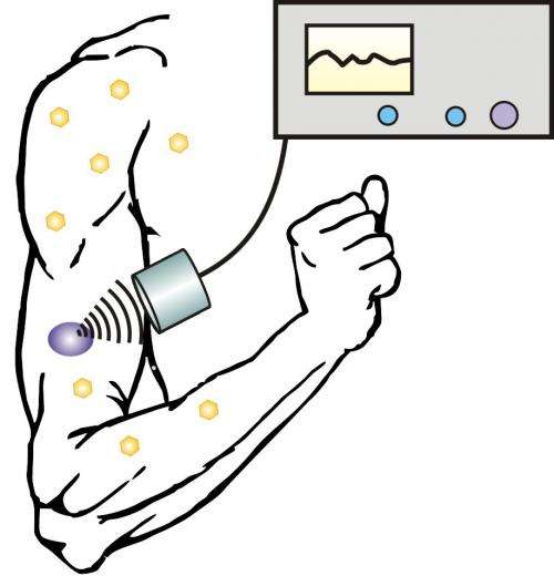 Ultrasound, nanoparticles may help diabetics avoid the needle
