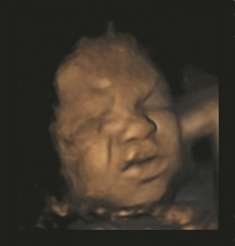 Unborn babies ‘practise’ facial expressions in the womb