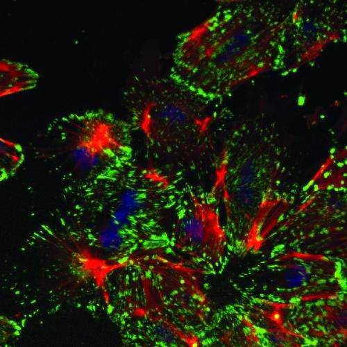 Uni Basel researchers discover master regulator in cancer metastasis