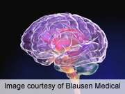 Vascular markers linked to cognitive decline in diabetes