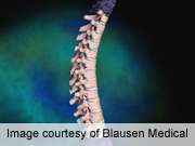Weekend spine surgery linked to longer stays, higher costs