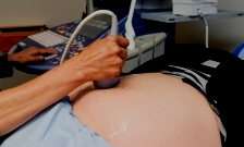 World first pre-eclampsia test could save hundreds of babies