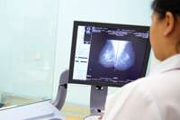 Young black women less likely to survive breast cancer