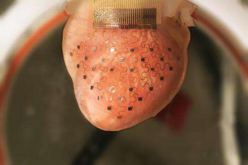 3-D printer creates transformative device for heart treatment (w/ Video)