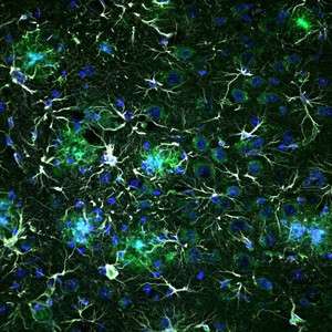 Alzheimer's disease: Molecular signals cause brain cells to switch into a hectic state