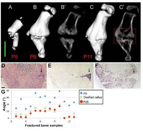 Discovery of how newborn mice repair bone fractures could improve treatments