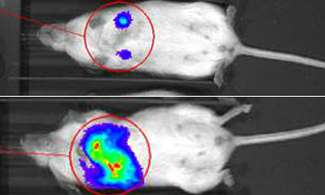 控制乳腺癌转移的酶被发现