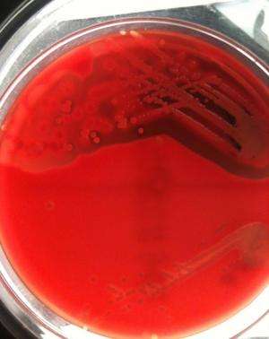 Genome sequencing of MRSA infection predicts disease severity
