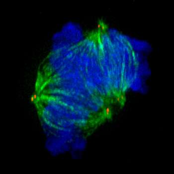 Impaired cell division leads to neuronal disorder