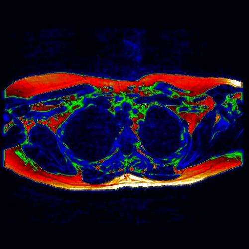 Key milestone for brown fat research with a ground-breaking MRI scan