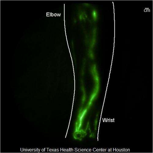 Lasers and night-vision technology help improve imaging of hidden lymphatic system