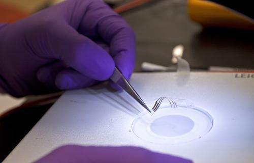 New implanted devices may reshape medicine