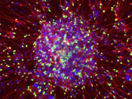 Patient stem cells used to make dementia-in-a-dish; help identify new treatment strategy