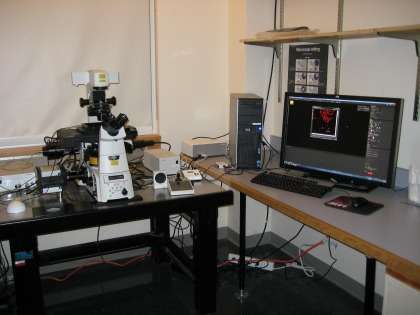 Researchers harness the power of super-resolution microscopy
