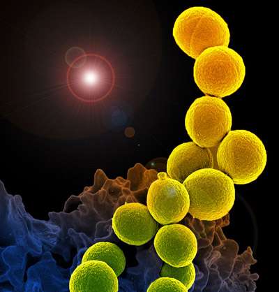 Researchers launch Phase 1 clinical trial of potential MRSA treatment