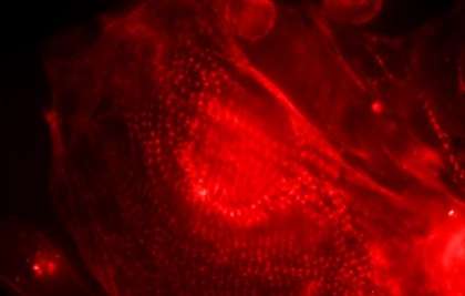 Scientists grow tiny beating human hearts to give them heart disease and find a cure