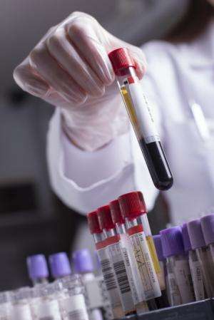Simple blood test could be used as tool for early cancer diagnosis