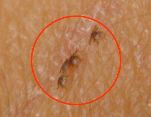 Test for persistent Lyme infection using live ticks shown safe in clinical study