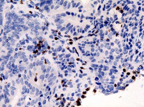Researchers at IRB discover a key regulator of colon cancer