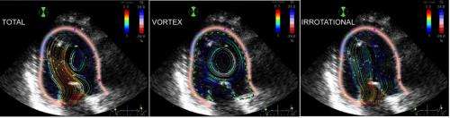 Engineers develop novel ultrasound technology to screen for heart conditions